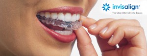 Invisalign-Top